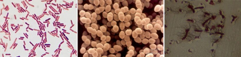 E. coli, enterococul fecal și proteusul sunt principalii agenți cauzali ai prostatitei bacteriene cronice